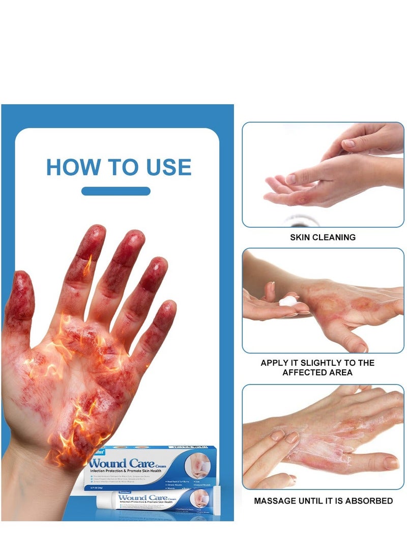 سوميفون كريم العناية بالبشرة للحروق والحروق - Image 4